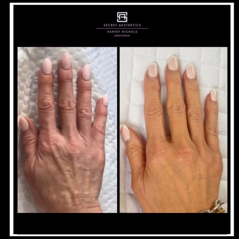 Polynucleotides Hand Treatment Before and After