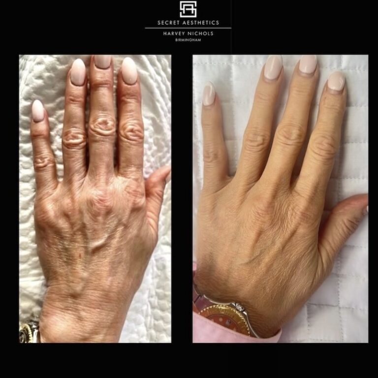 Polynucleotides Hand Treatment Before and After
