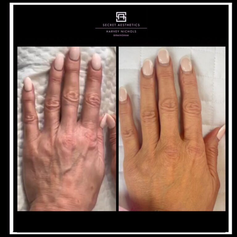 Polynucleotides Hand Treatment Before and After