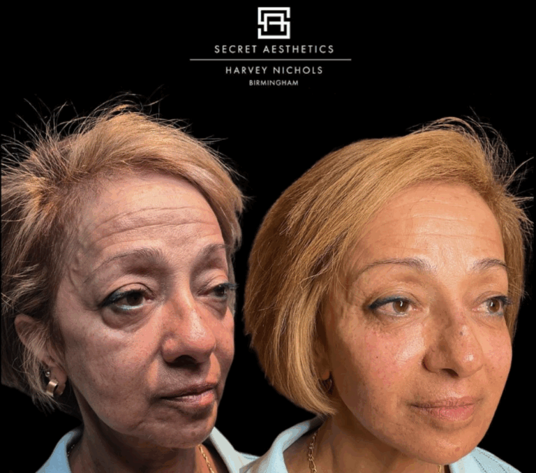 Screenshot 2025-08-28 at 3.44.47 pm